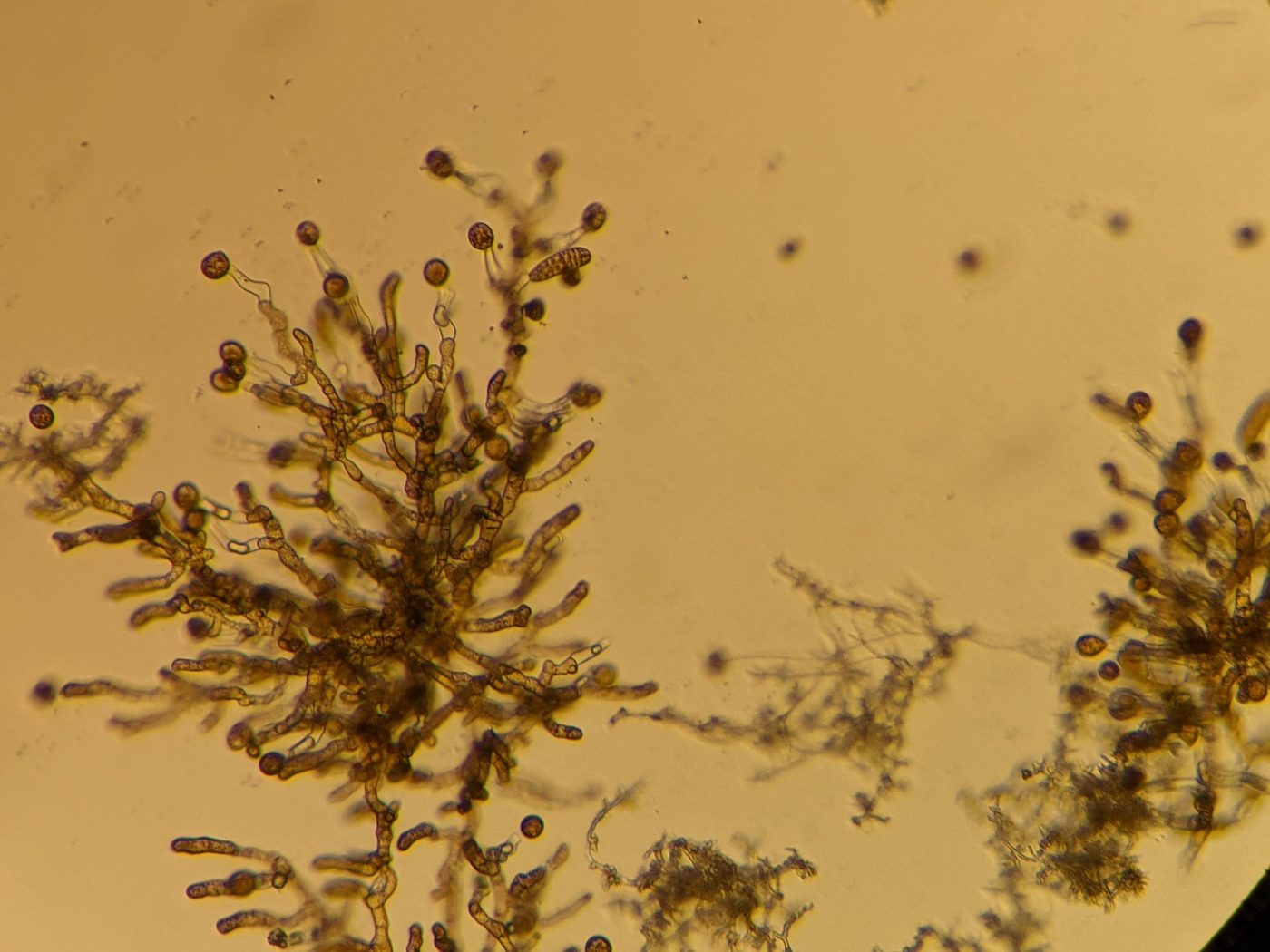 Gametofitos de huiro con óvulos, vistos al microscopio