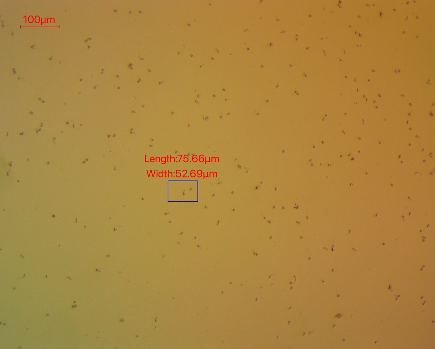 Zoosporas de huiro recién liberadas, vistas al microscopio